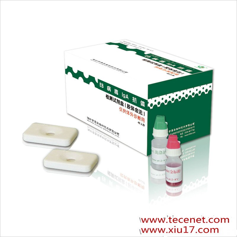 抗精子抗体检测试剂盒（胶体金法）