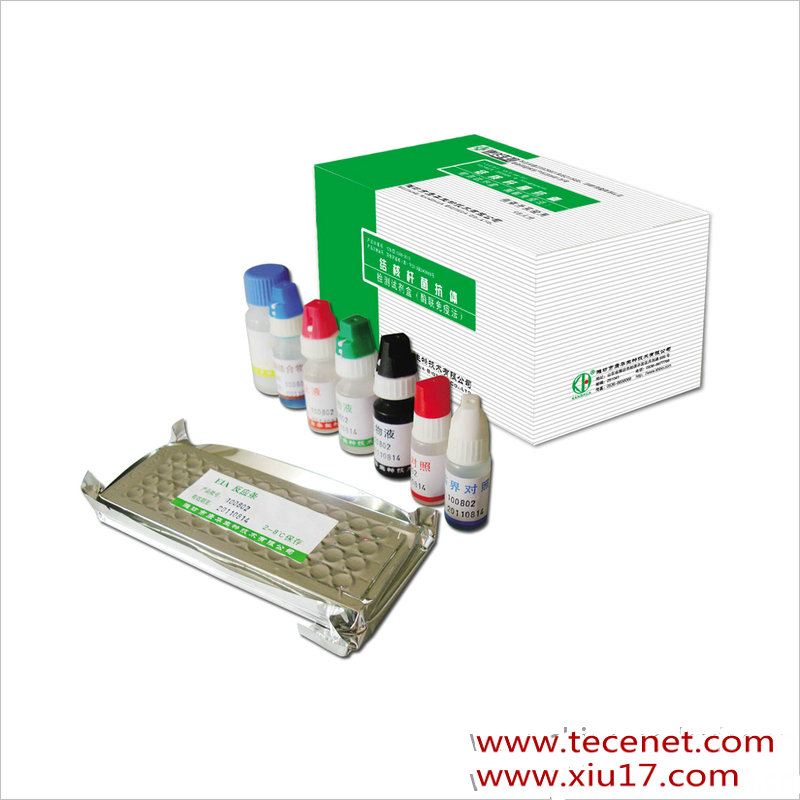 抗精子抗体IgA测定试剂盒（化学发光法）